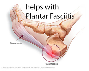 from the Mayo Clinic, about heel pain - plantar fasciitis
